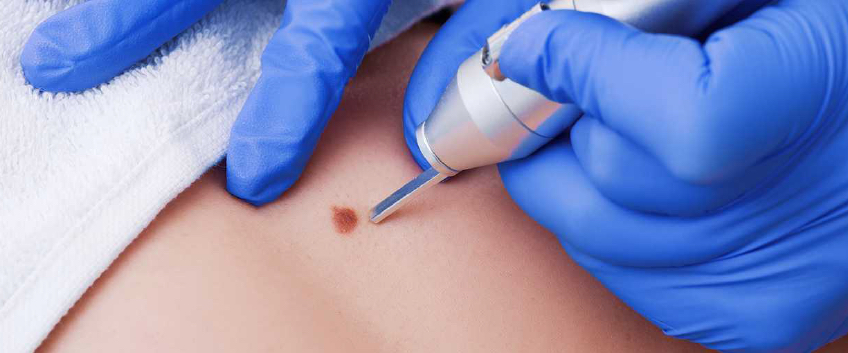 Ben Muayenesi İçin Ne Zaman Doktora Gidilmeli?